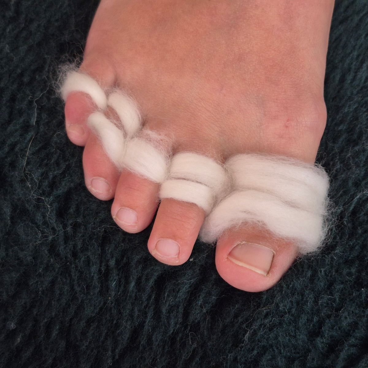 Merino Wool 19 Micron Strand Medical/Therapeutic use